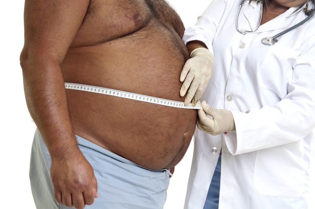 obesidade - Shutterstock